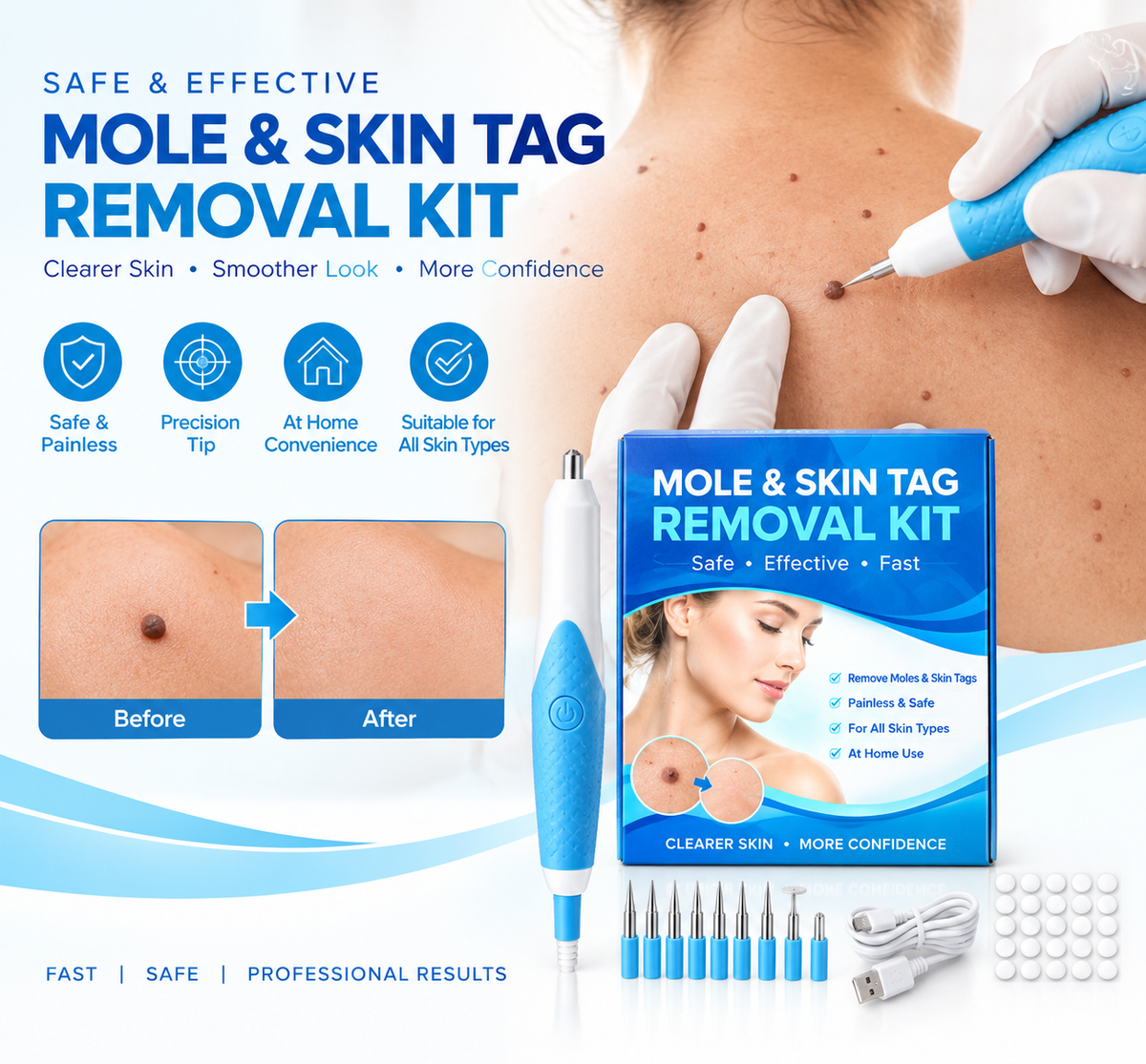 Auto Skin Tag Remover