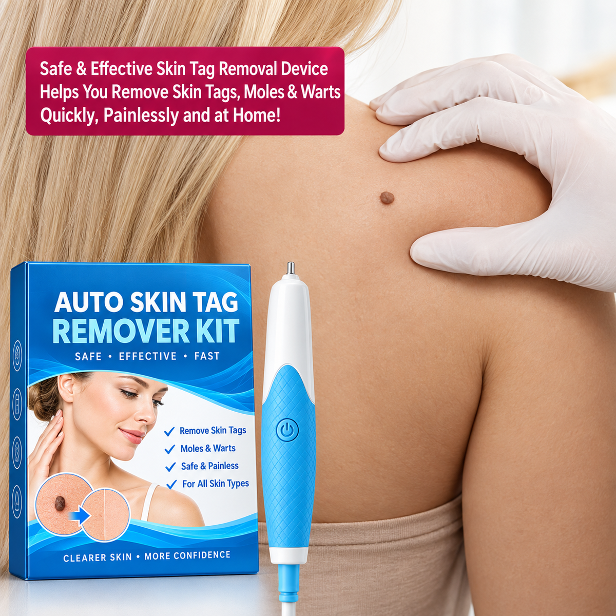 Auto Skin Tag Remover