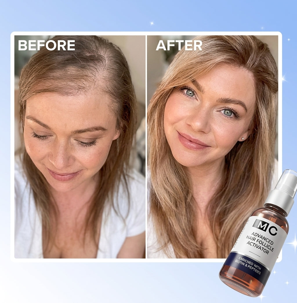 FEG Plus Hair Growth Spray