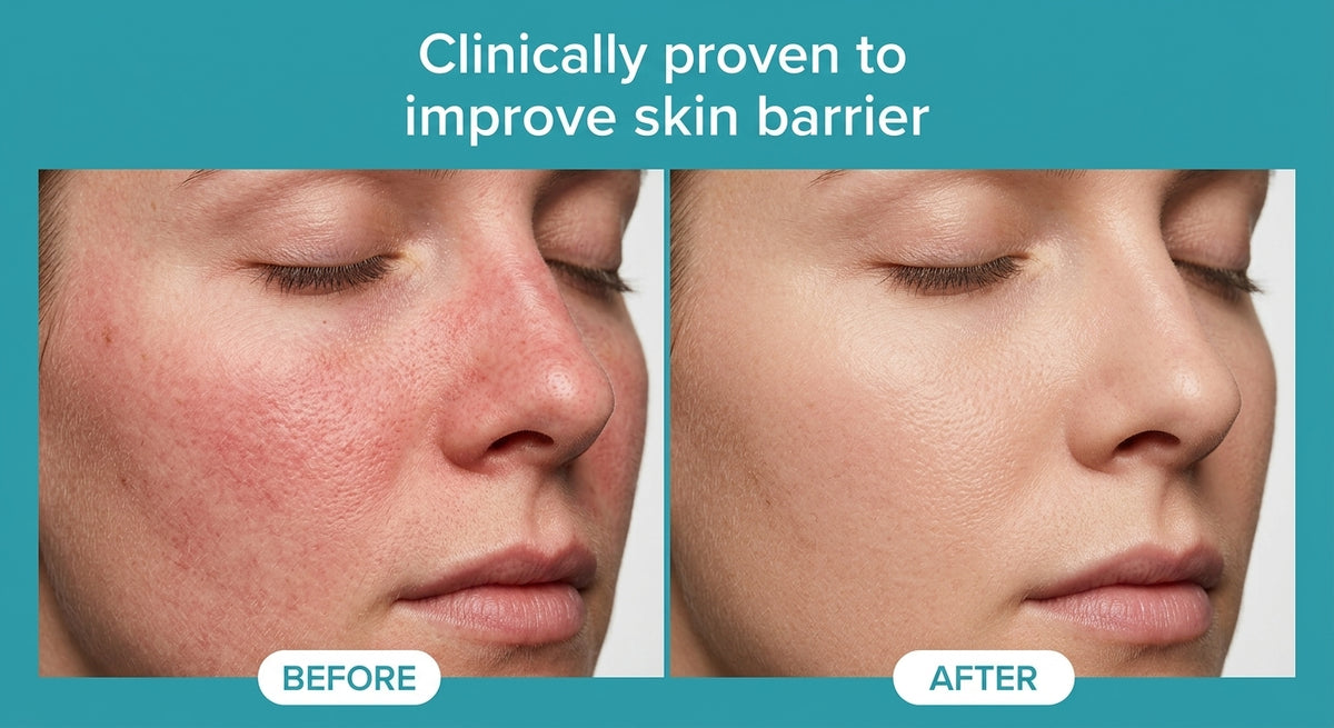 Skin Perfecting 2% BHA Liquid Exfoliant